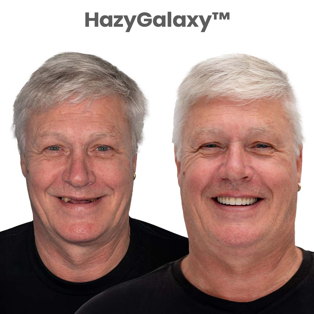⭐HazyGalaxy™ Custom-Fit Dentures ⏰ ENDS TODAY   70% OFF | Smile with Confidence